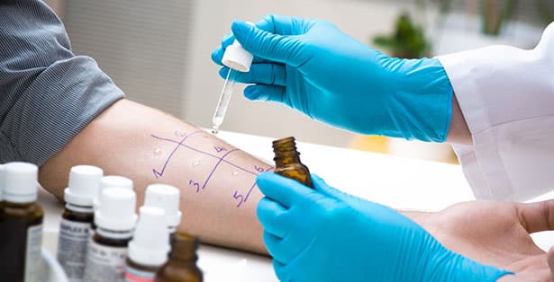 Doctor administering an allergy test